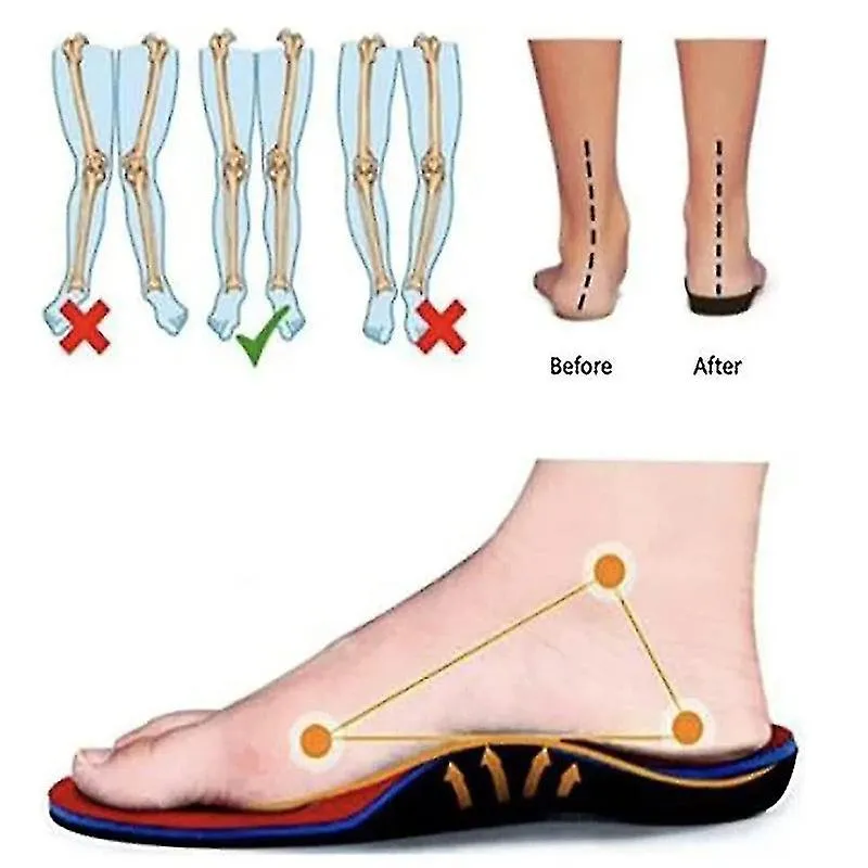 Zapatillas ortopédicas para mujer, zapatillas de malla para plataformas elásticas, zapatillas cómodas de moda casual para camina